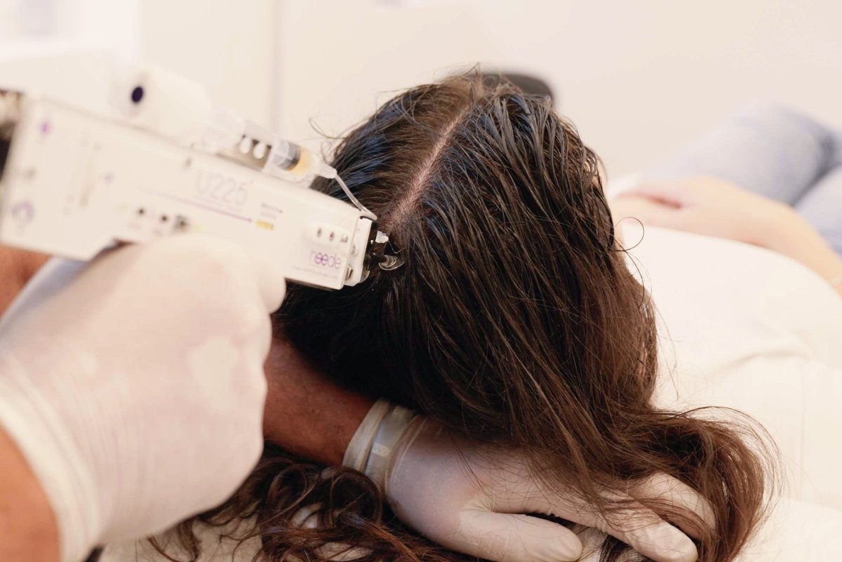 Haarwachstumsbehandlung mit Mesoinjektor bei MYH&B