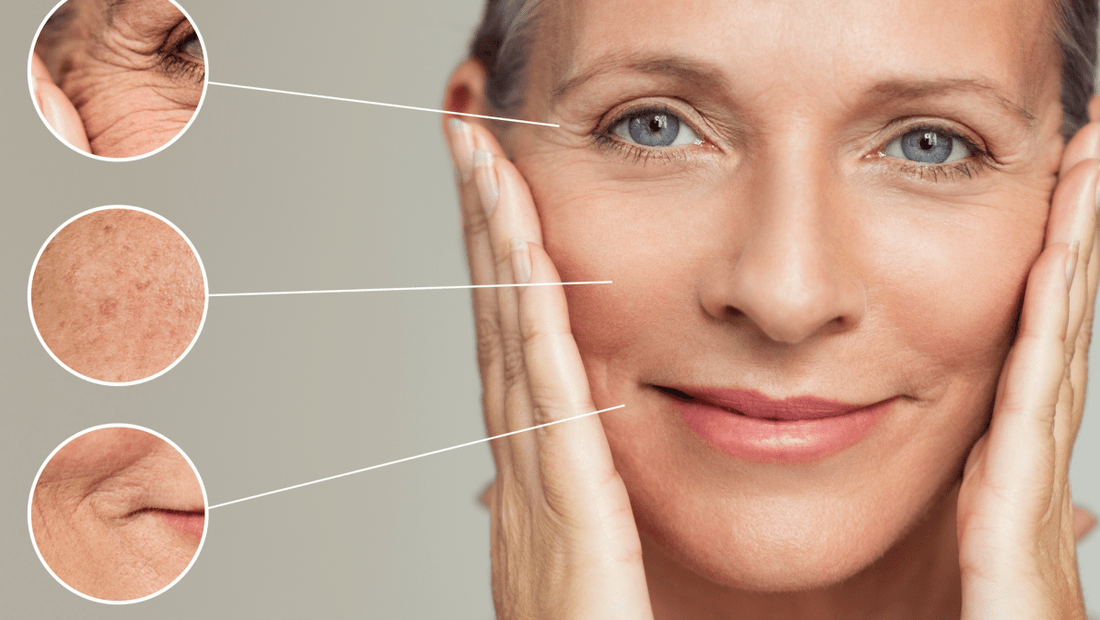 Frau mittleren Alters mit Fokus auf Falten und Pigmentflecken – Zielzonen moderner Anti-Aging-Behandlungen
